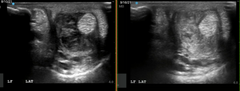 Check Ligament Injury in Young Mare