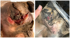 Overreach Injury Managed with Regenaflex-GEL